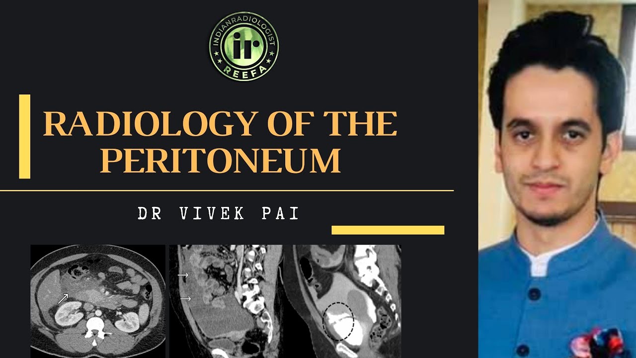 RADIOLOGY OF THE PERITONEUM | VIVEK PAI | PERITONEAL SPACES | ABDOMINAL CT | PERITONEAL METS