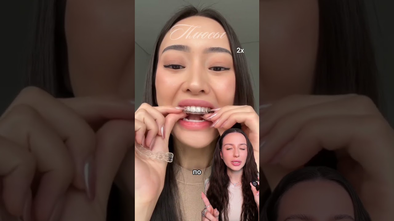 Хотели бы себе элайнеры или все-таки отдаете предпочтение брекетам? 🦷 УК