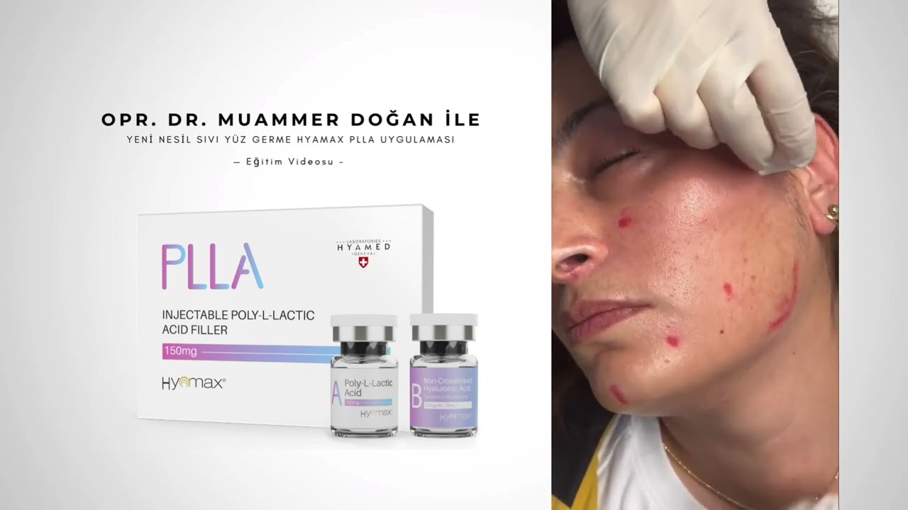 Sıvı Yüz Germe Hyamax PLLA Uygulaması Eğitim Videosu