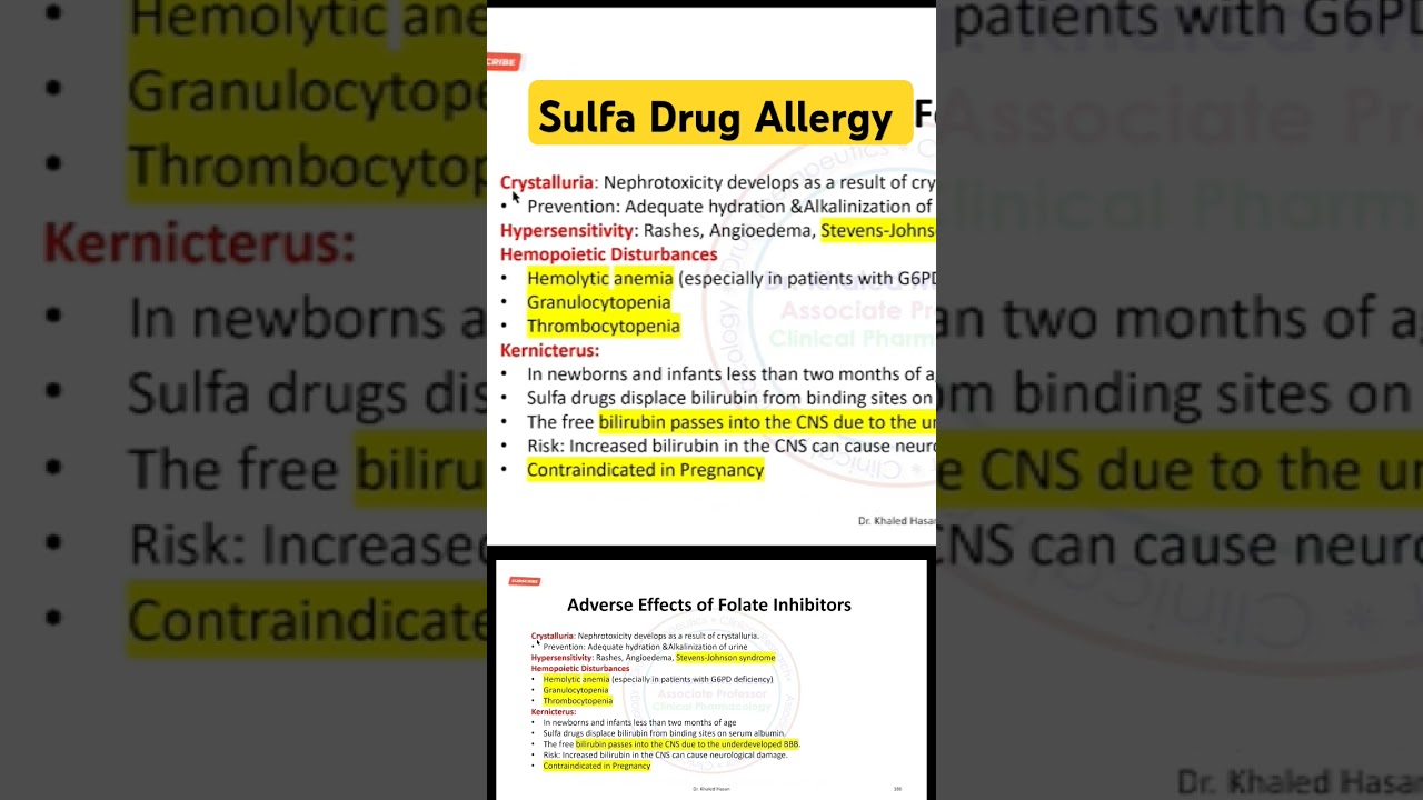 Sulfa Drug Allergy