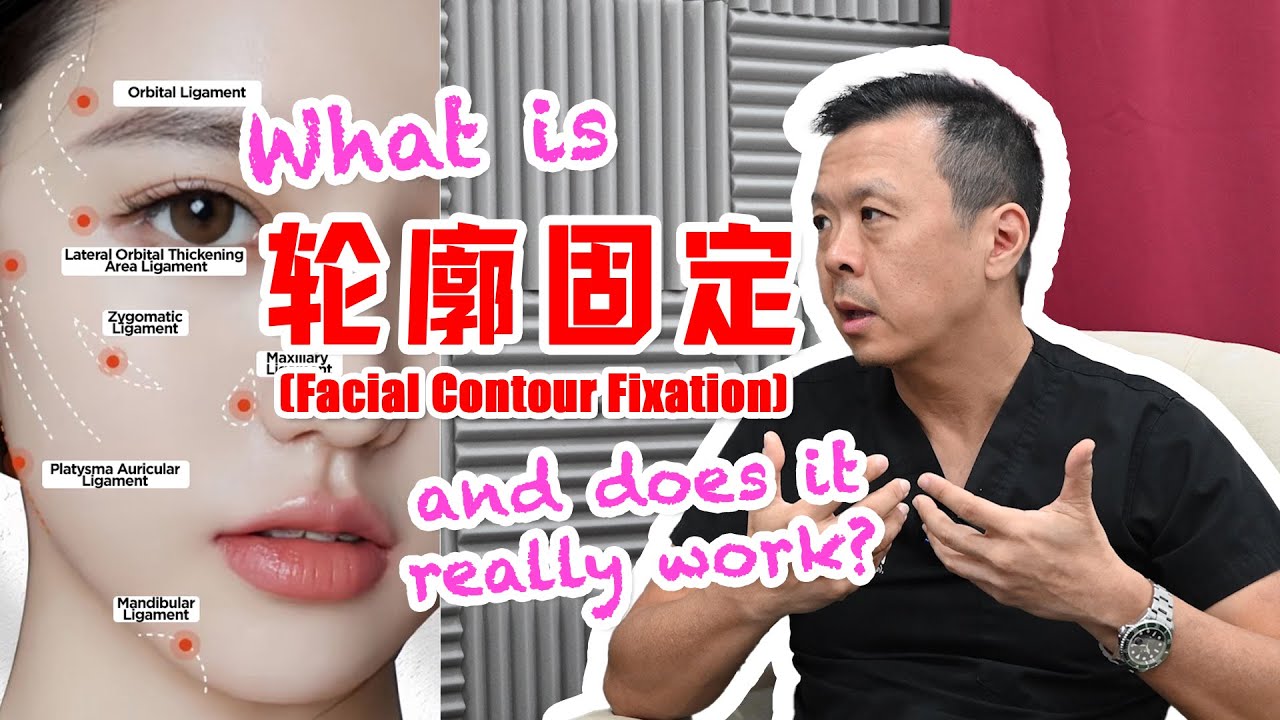 What is Facial Contour Fixation (轮廓固定)?