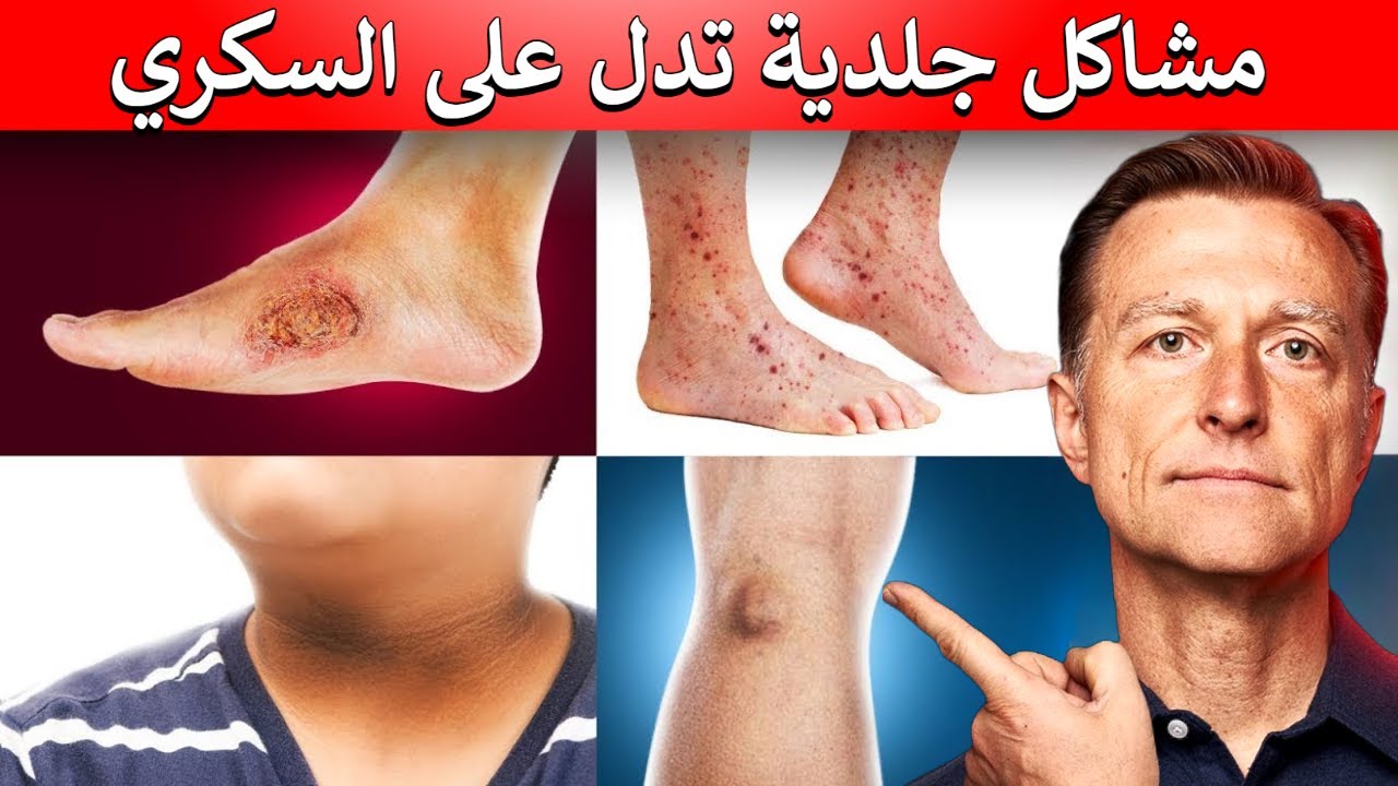 تسعة مشاكل جلدية تخبركم بمرض السكري على الجميع حتماً أن يعرفوها
