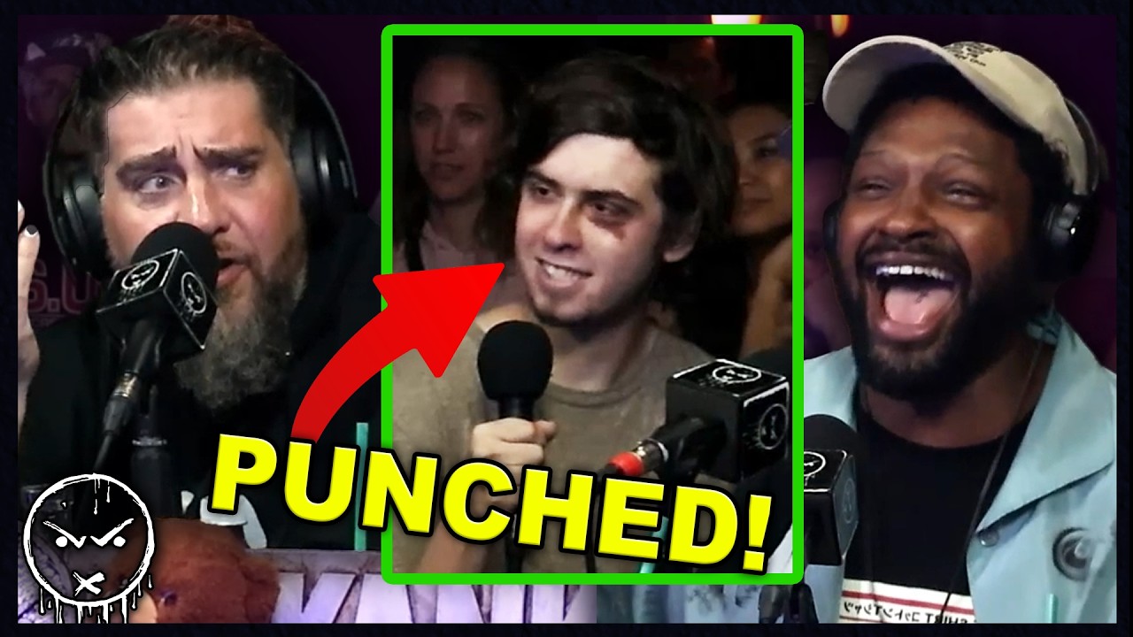 What Got Blind Mike PUNCHED In The Eye? 👊💥