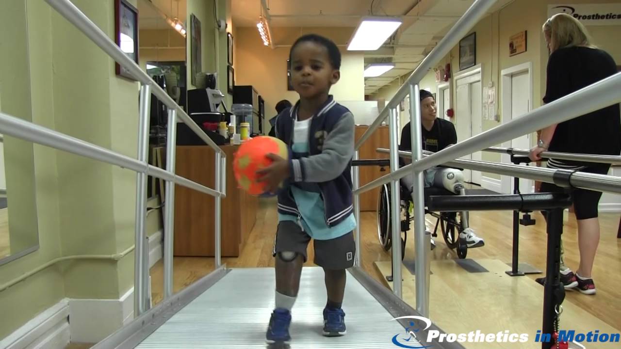 2 1/2 Year Old Below Knee Amputee Having Fun!!!