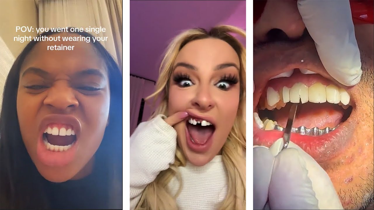 Tiktok Teeth Trends Gone WRONG!