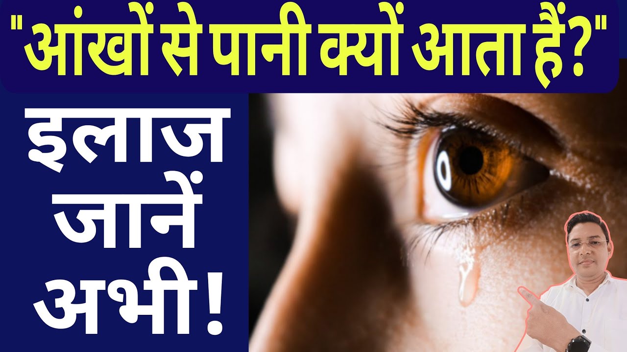 आंखों से पानी आना: कारण और इलाज