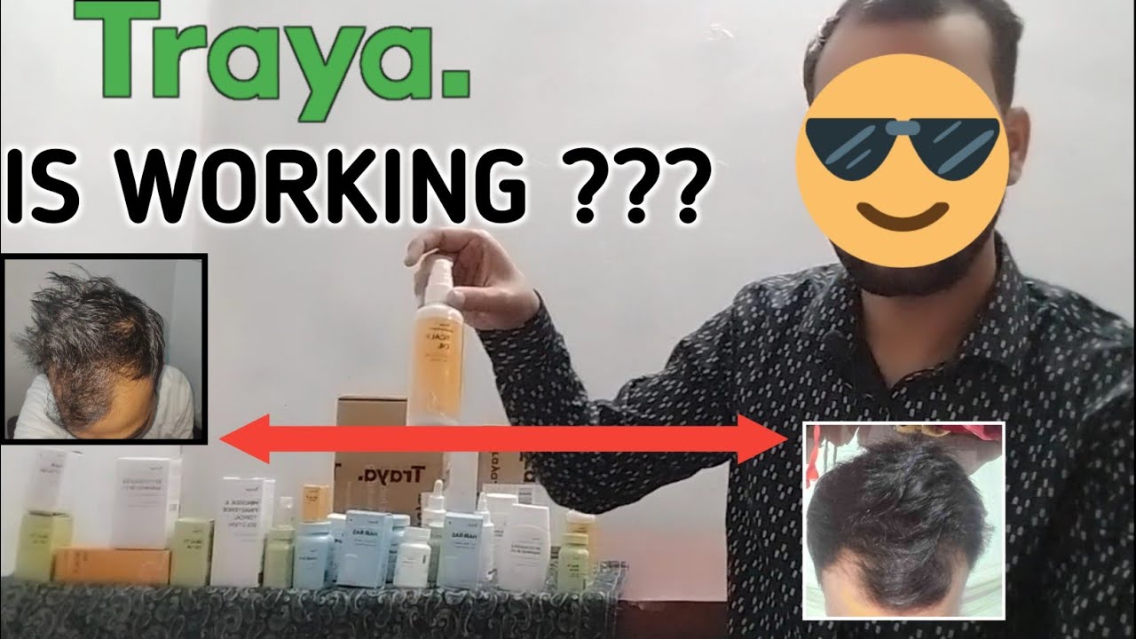 Traya Hair Review Hindi || Traya Results | Traya Health Hair Review || #Trayahairreview #trayahealth