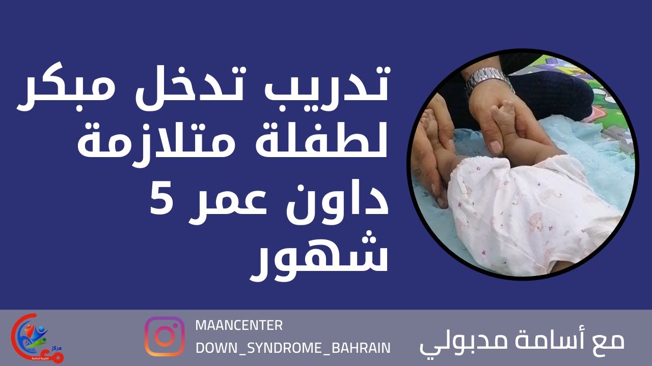 تدريب تدخل مبكر لطفلة متلازمة داون عمر 5 شهور | مع اسامة مدبولي