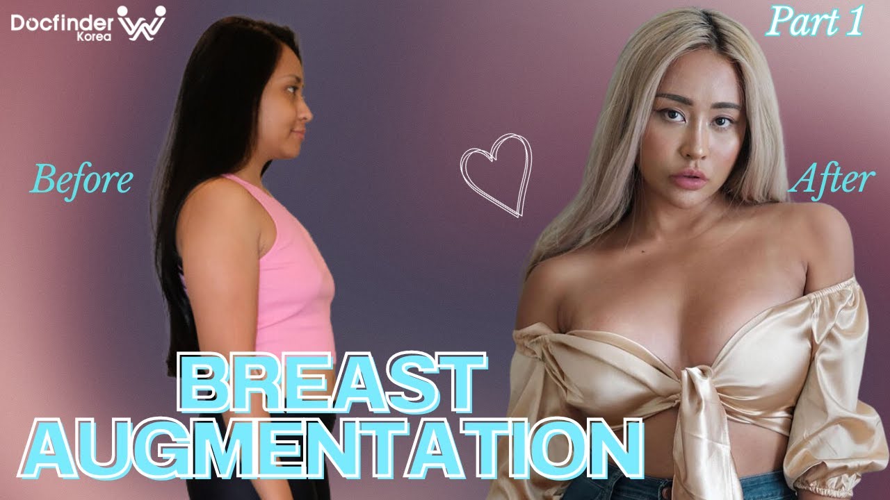 Indonesian beauty trendsetter gets BOOB JOB and ANTI-AGING surgery in Korea part 1