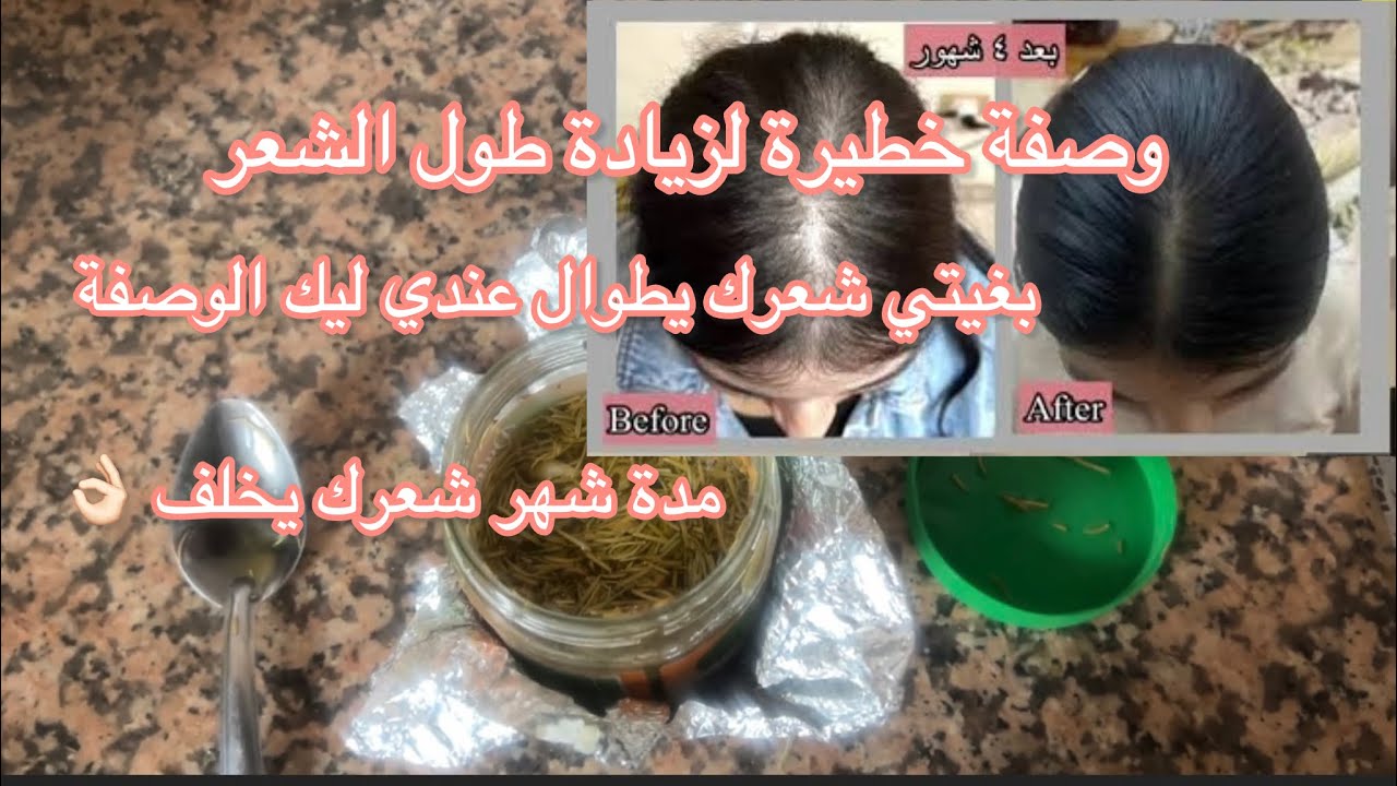وصفة خطيرة لزيادة طول الشعر | Recipe for increasing hair length