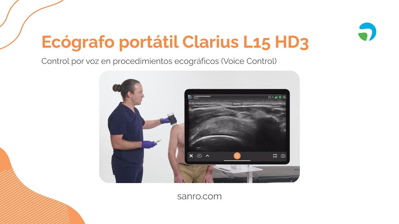 Ecógrafo Clarius L15 HD3 - Control por voz en procedimientos | Sanro Electromedicina