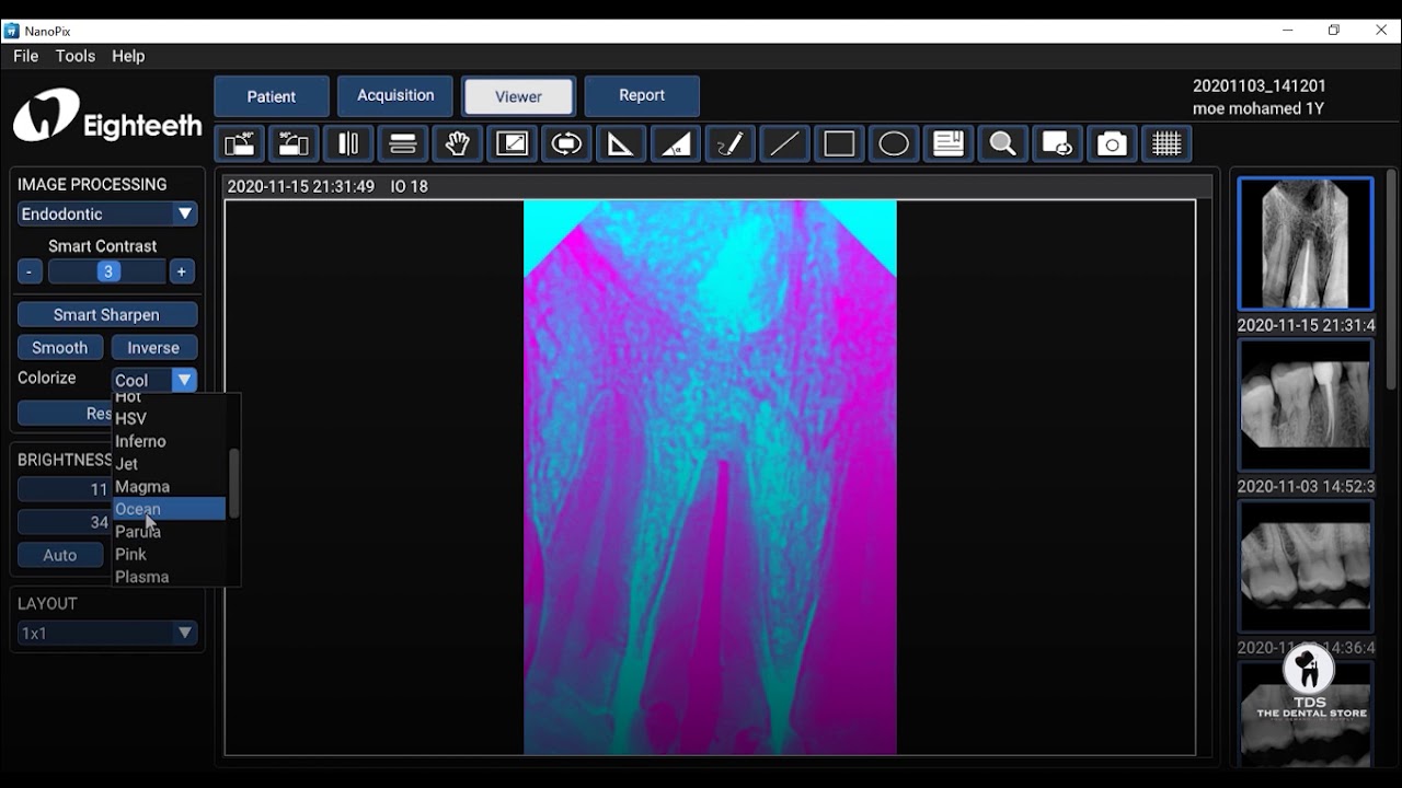 Tutorial - The Complete Guide To NanoPix X-Ray Sensor Software By Dr.Mohamed Tawakol - TDS, Egypt