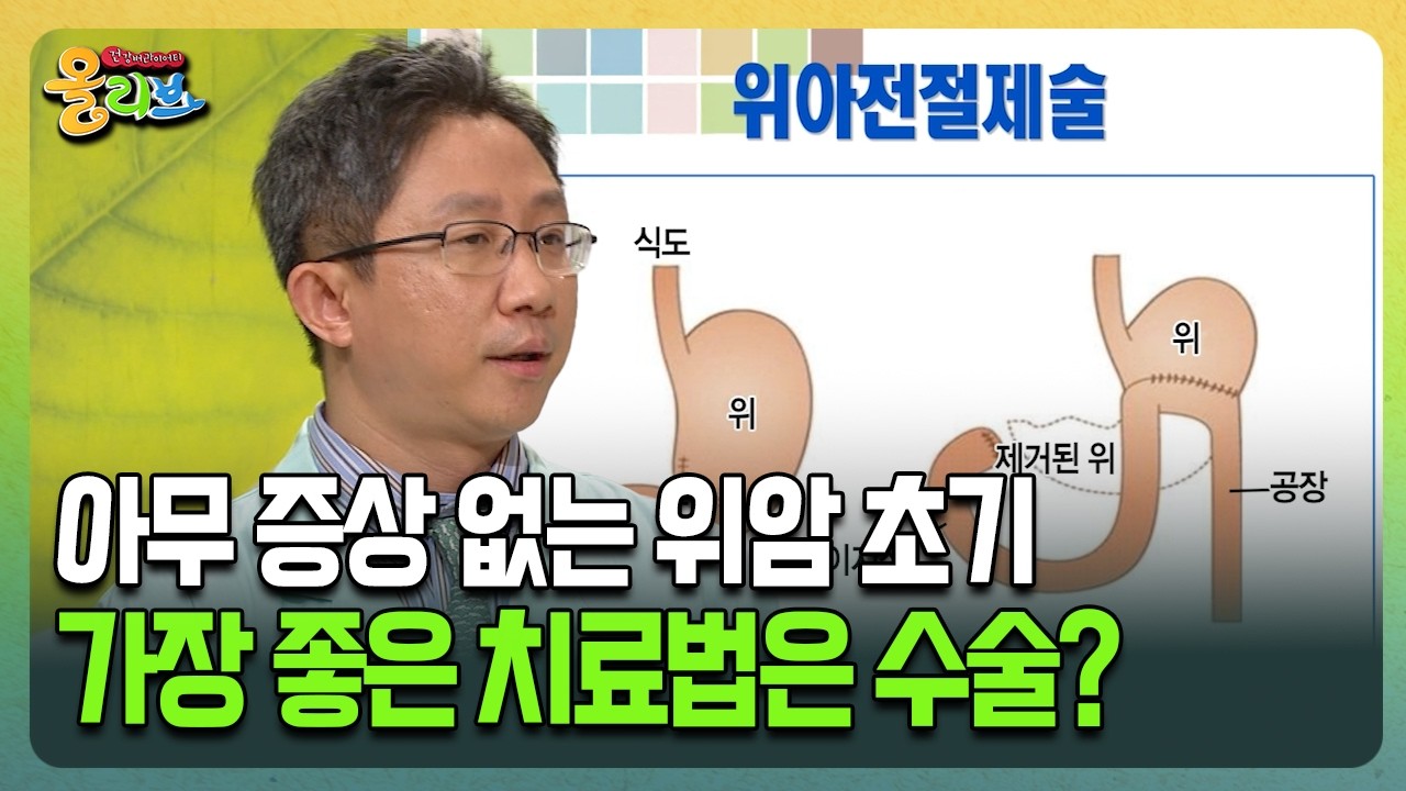 [건강버라이어티 올리브] 아무 증상 없는 위암 초기 가장 좋은 치료법은 수술?