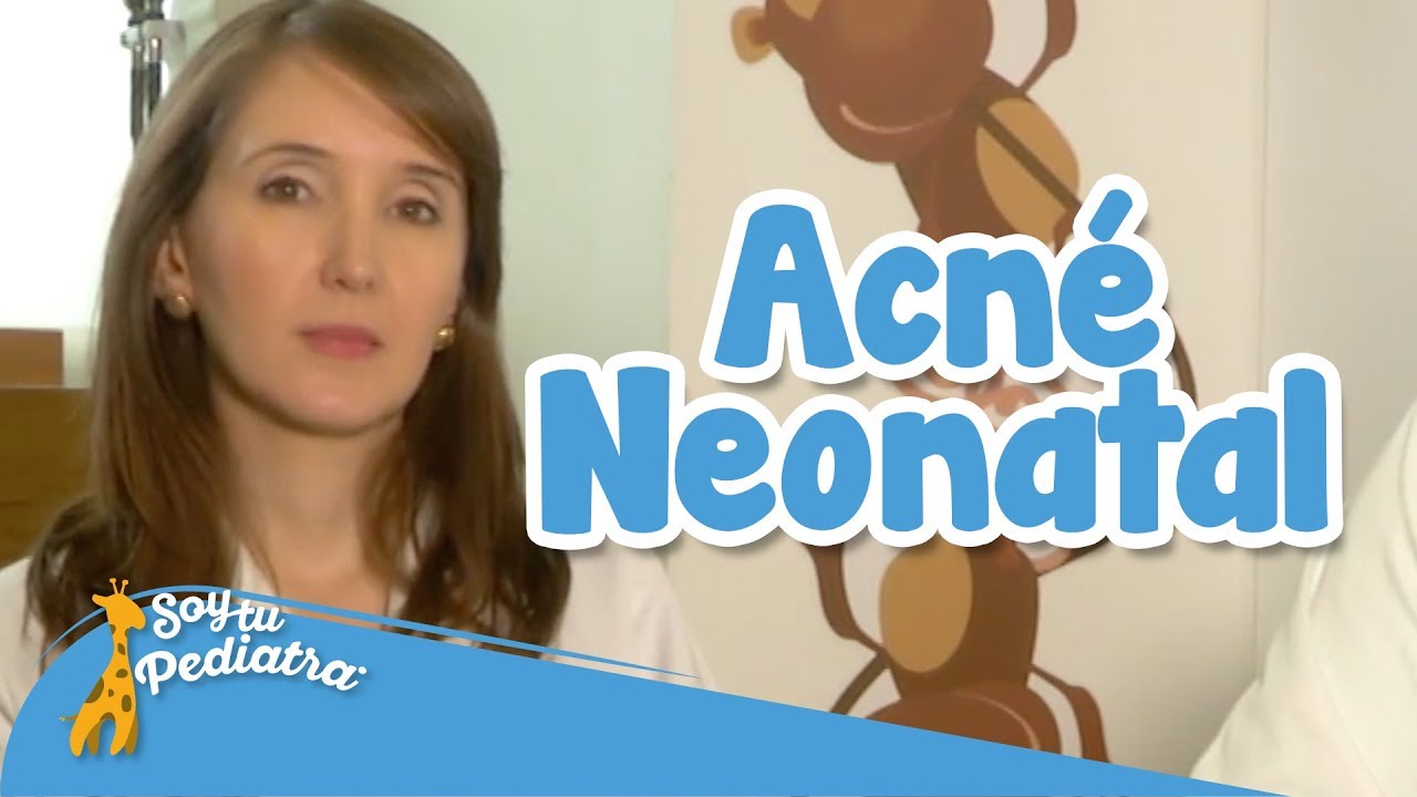 Acné Neonatal: Causas, Tratamiento y Cuidados para la Piel del Bebé | Guía para Padres SoyTuPediatra