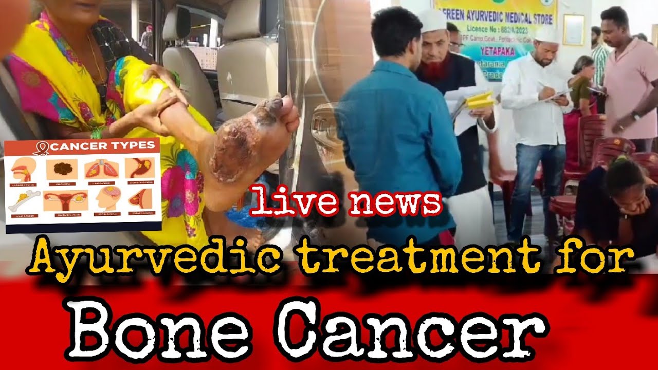 Bone Cancer Best Treatment in Ayurveda || 