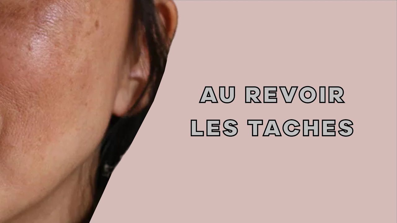 SOINS ANTI-TACHE DE PARAPHARMACIE EFFICACES !