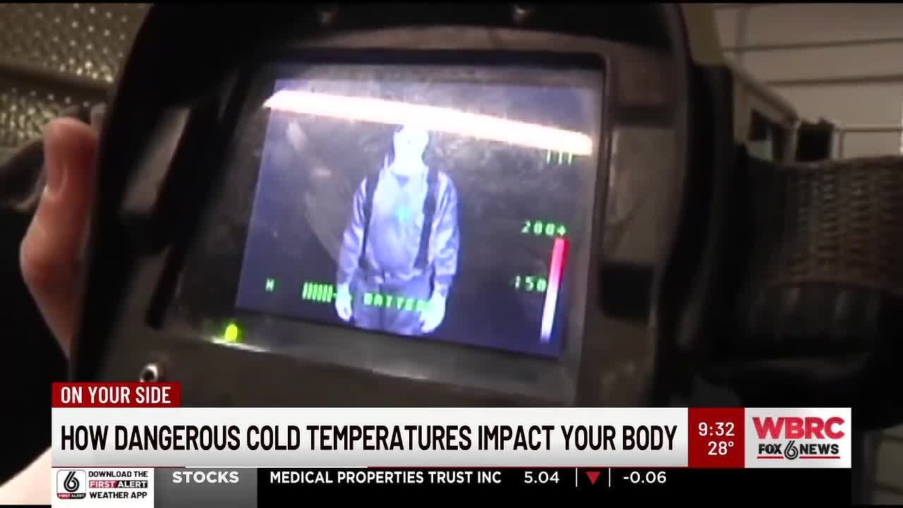 How dangerous cold temperatures impact your body