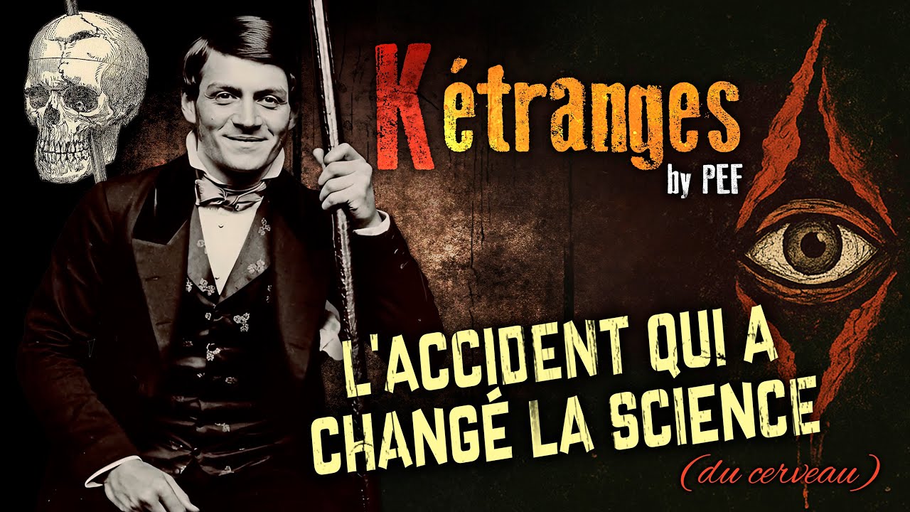 Phineas Gage : l’accident qui a changé la science (du cerveau)