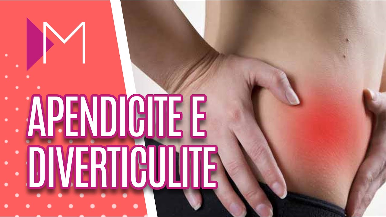 Apendicite e diverticulite - Mulheres (13/02/20)