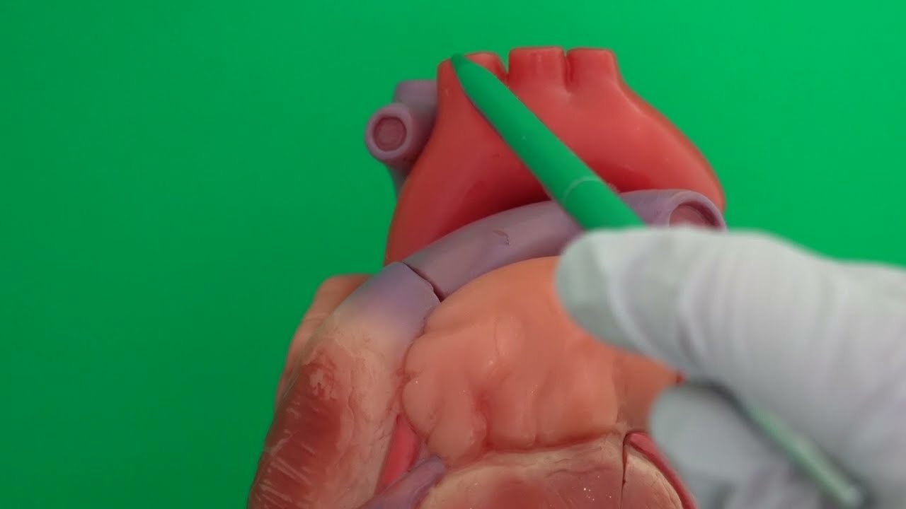 Aorta and Pulmonary Trunk and Their Main Upper Branches