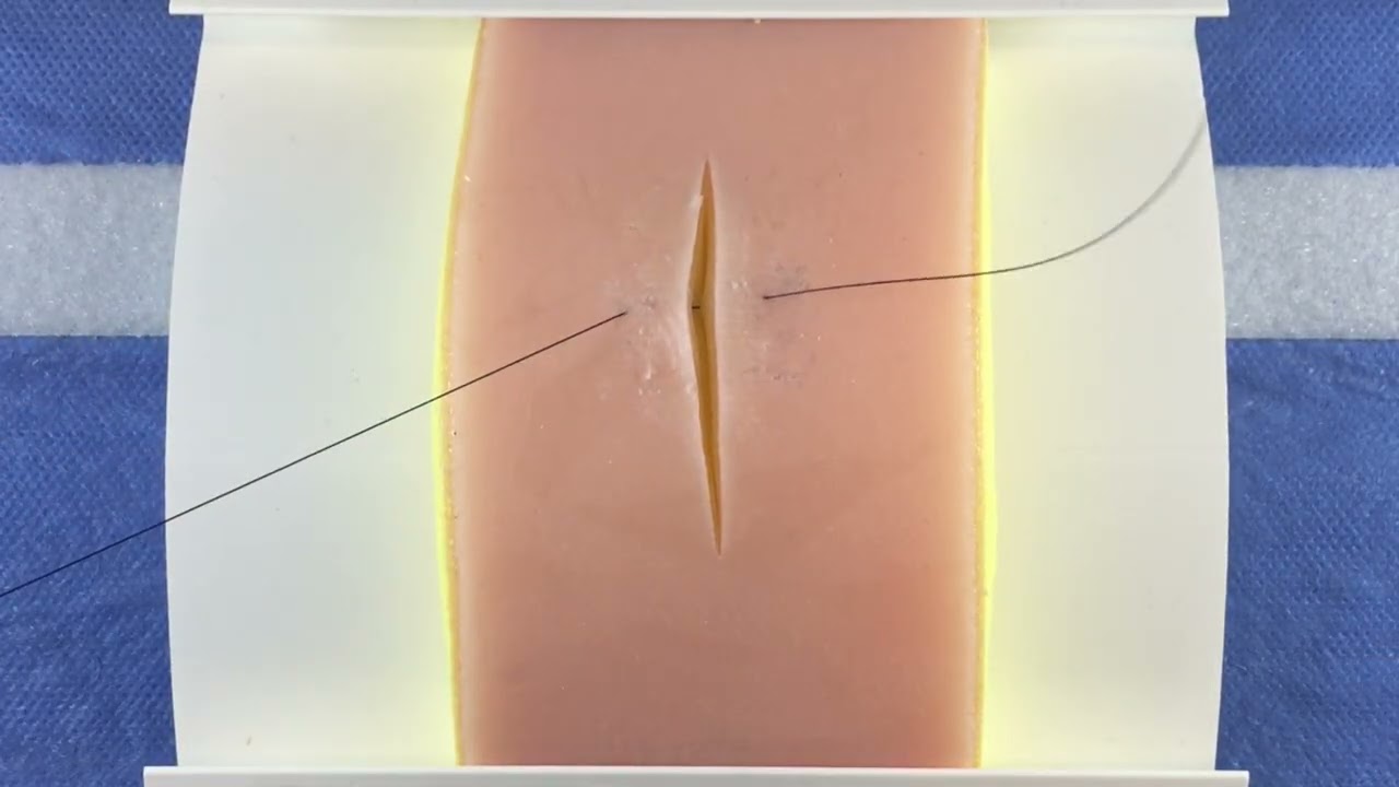 Horizontal Mattress Suture