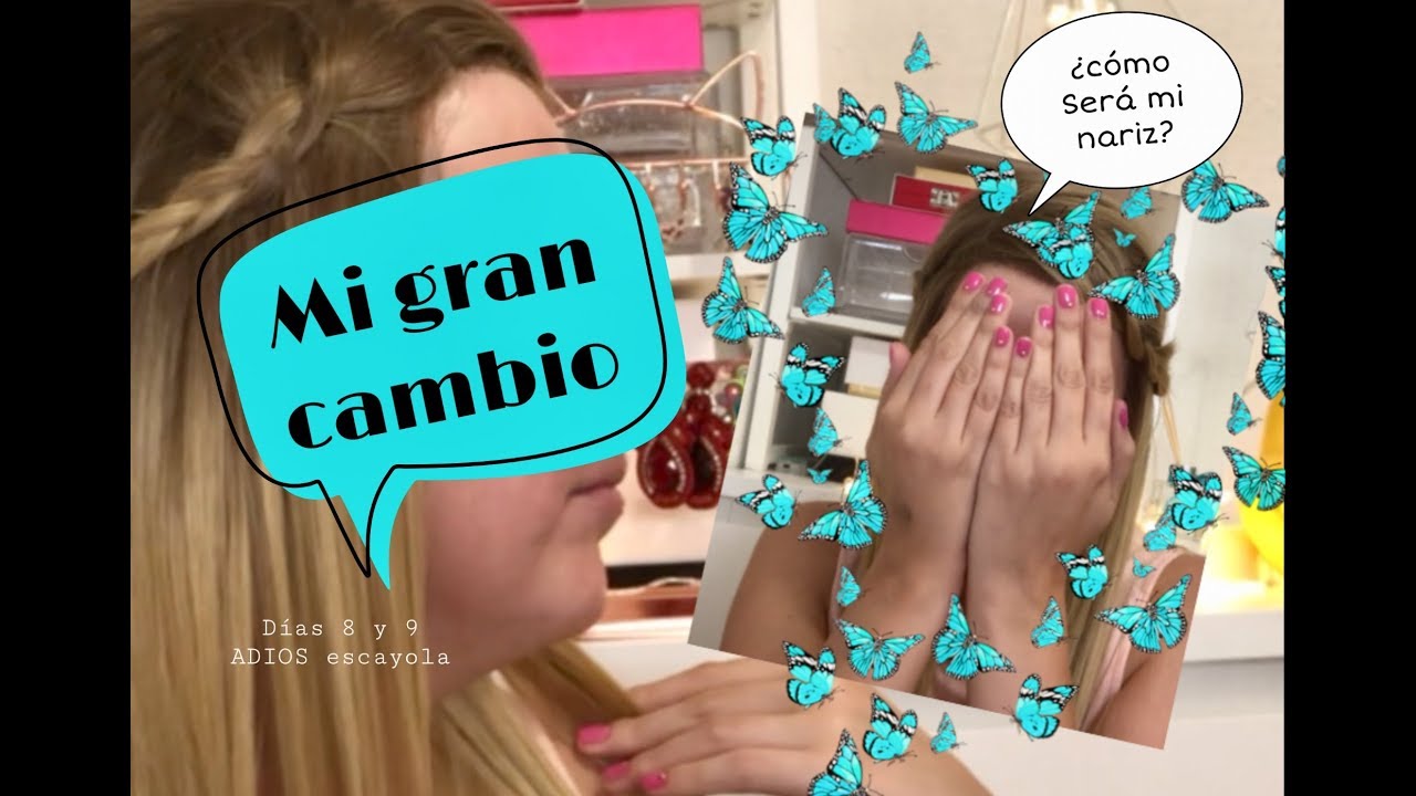 MI RINOPLASTIA- DIAS 8 y 9- ¡ME QUITAN LA ESCAYOLA!-DORSIA