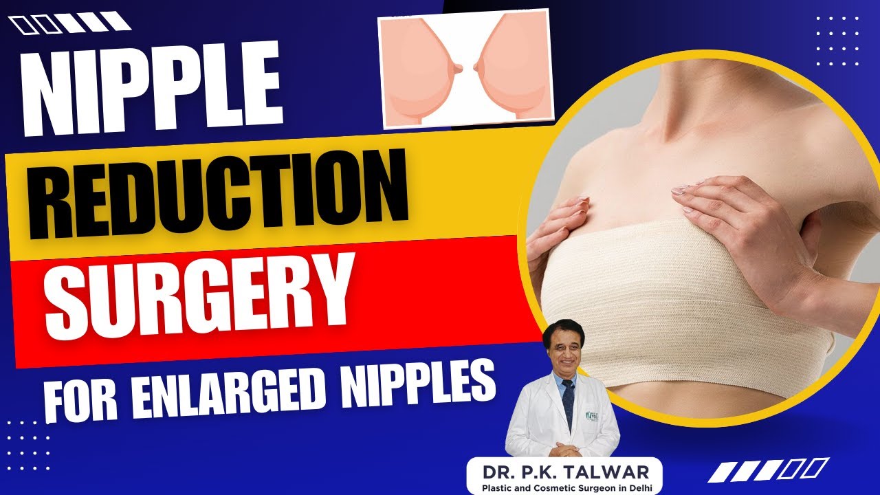 Nipple Reduction Surgery for Enlarged Nipples | Breast Surgery in Delhi | Dr. PK Talwar