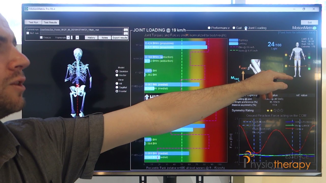Motion Metrix is finally at Essence Physiotherapy!