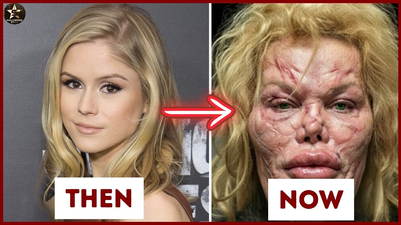 15 Celebrities Who Lost Their Natural Beauty to Plastic Surgery | Then and Now 2026