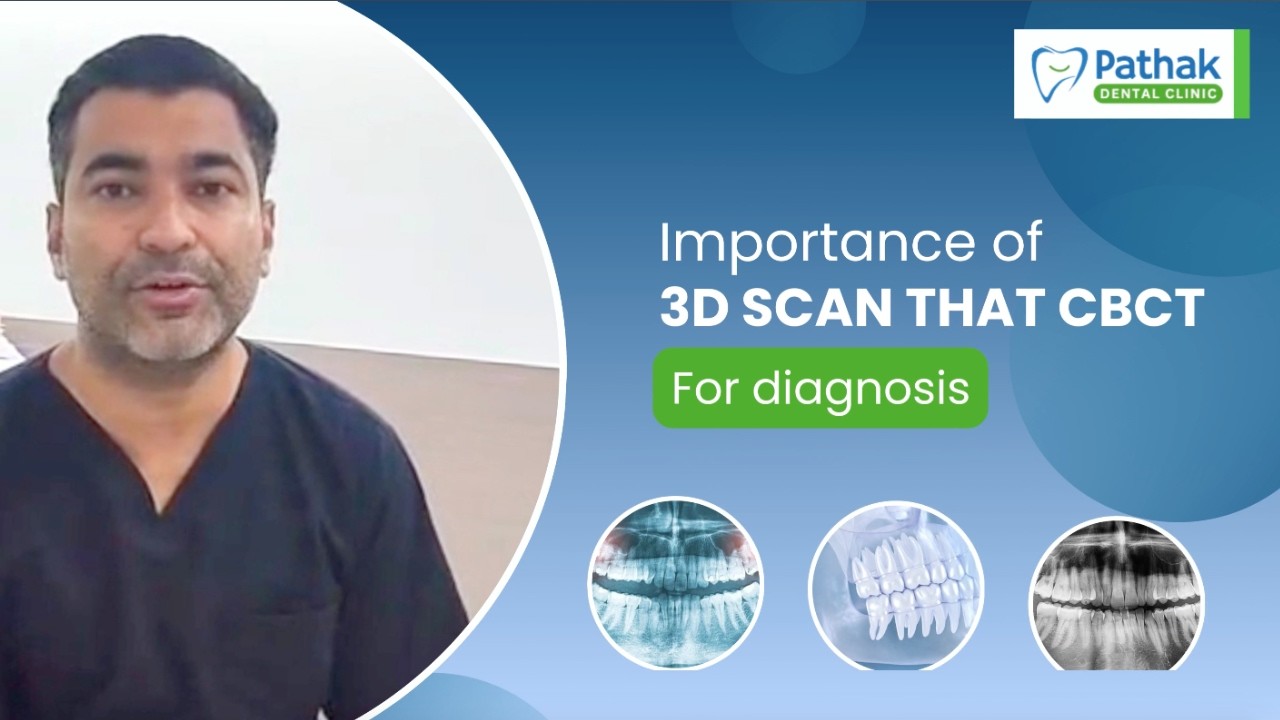 Best Dentist in Pune Explains Diagnosis | CBCT 3D Scan for Tooth Pain | Dentist Near Me