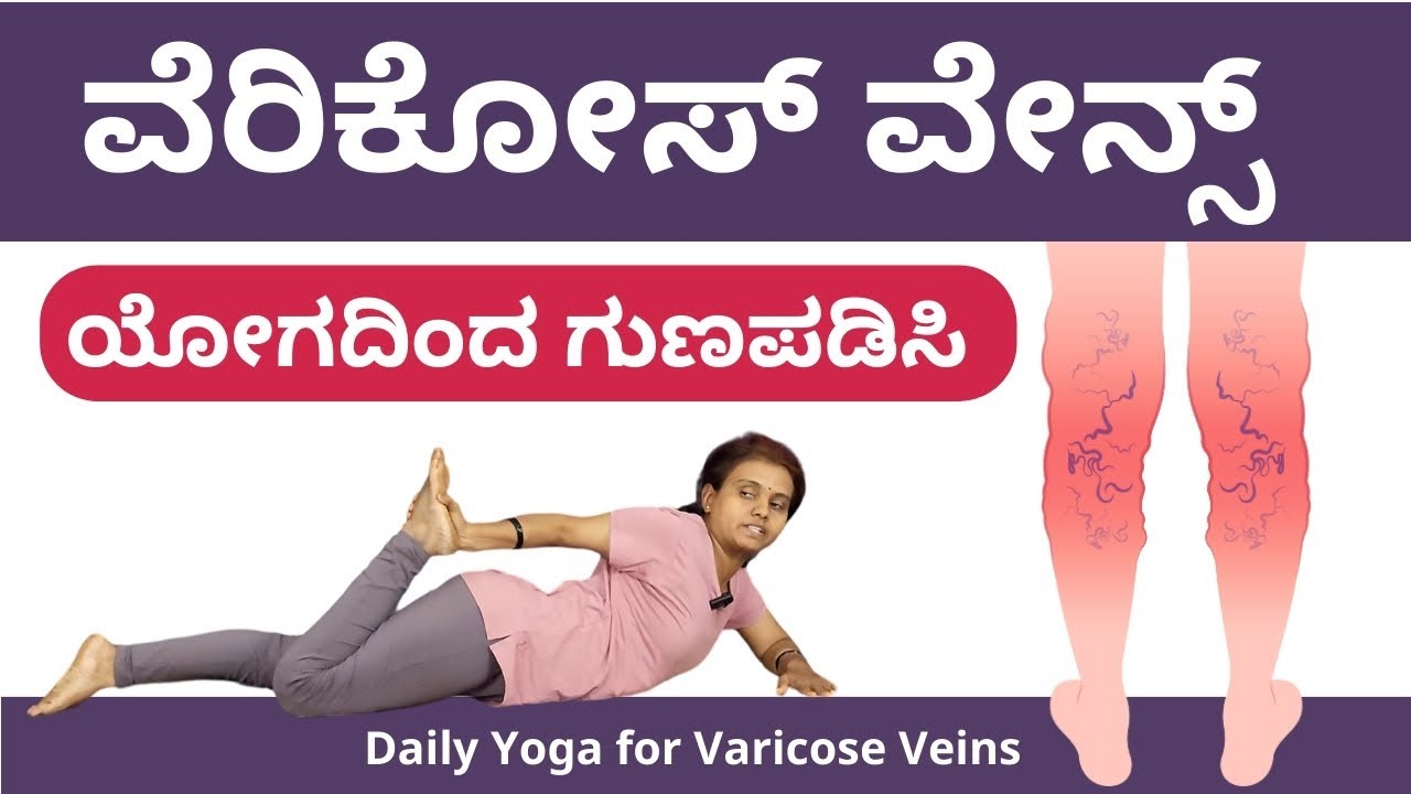Natural Remedies for Varicose Veins: Yoga Asanas for Relief and Recovery in Kannada | Manjula Yoga
