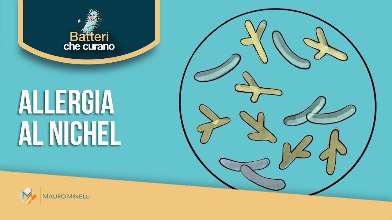 Batteri che curano: L'allergia al nichel