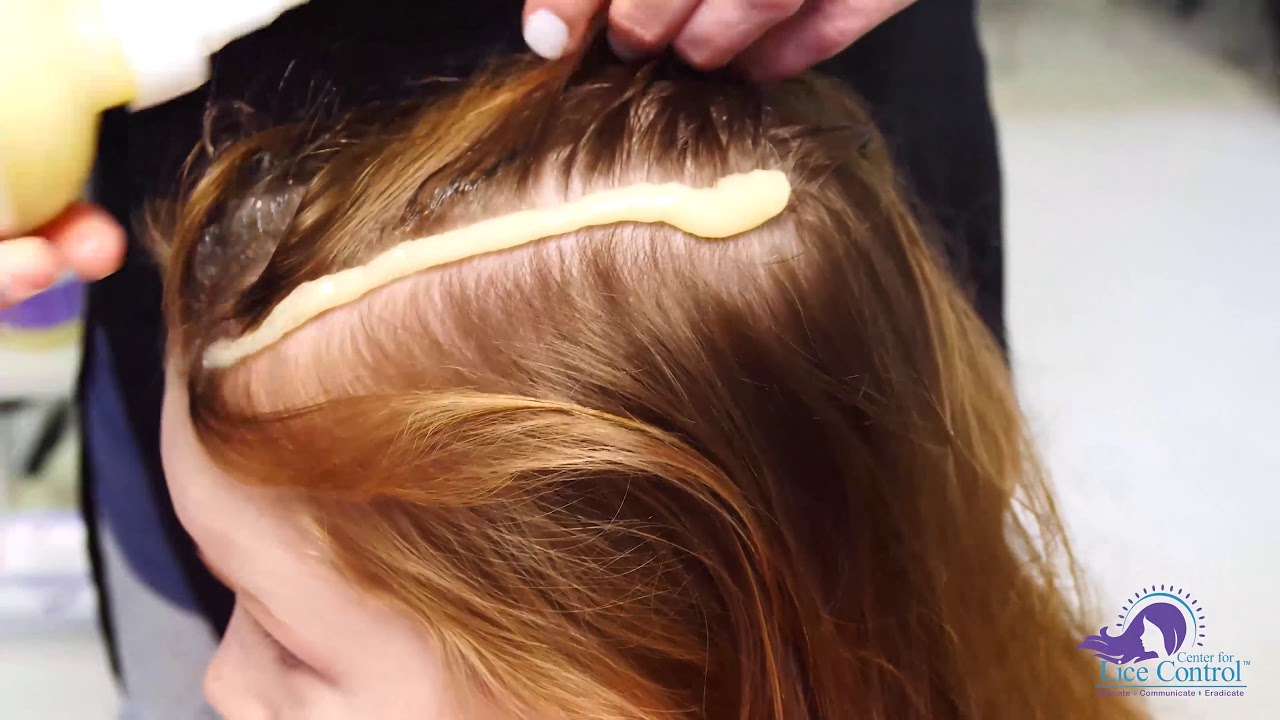 How to Apply the Lice Attack Solution -Medium to Long Hair