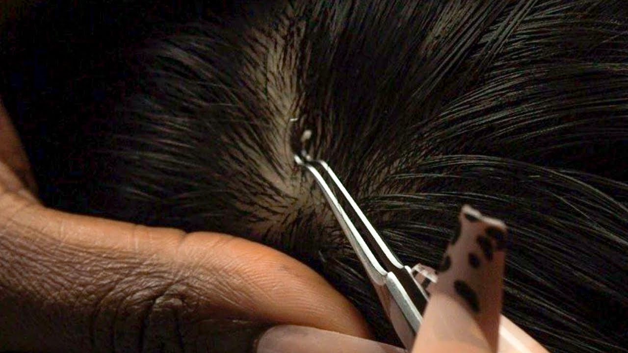 ASMR | Slowww & Specific Nitpicking With Tweezers & Nails 💅🏾 | Sensitive Whispers