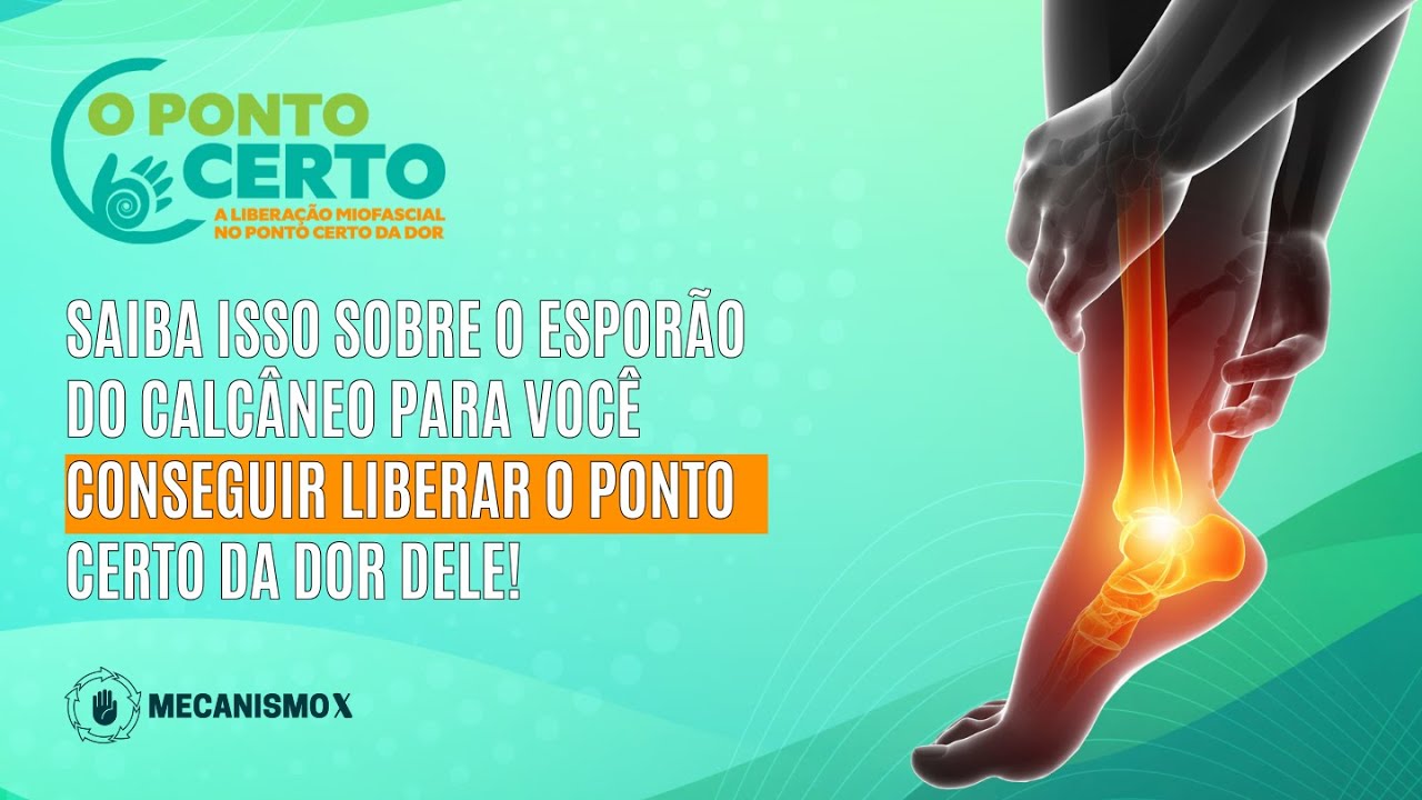 SAIBA ISSO SOBRE O ESPORÃO DO CALCÂNEO PARA VOCÊ CONSEGUIR LIBERAR O PONTO CERTO DA DOR DELE!