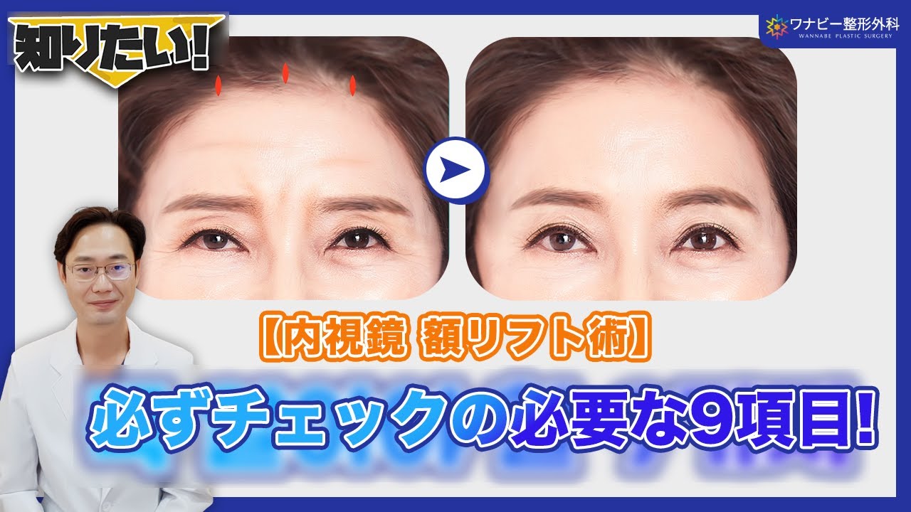 エンドタイン内視鏡 額リフト9つのポイント！