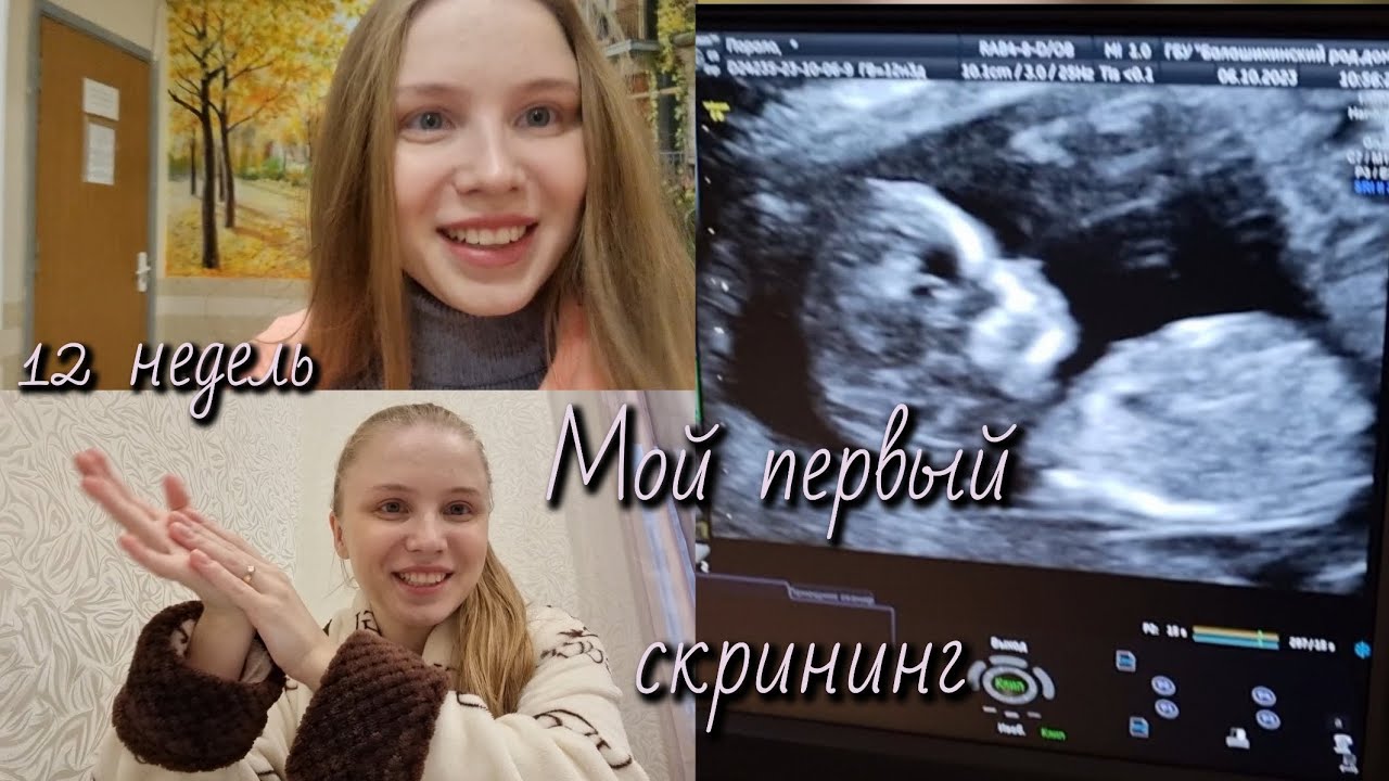 Первый скрининг🤰/12 недель беременности 💞