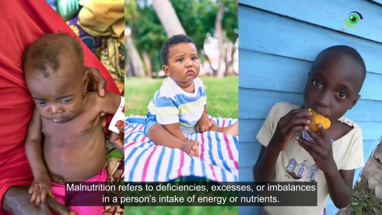 Tackling Obesity in Nigeria