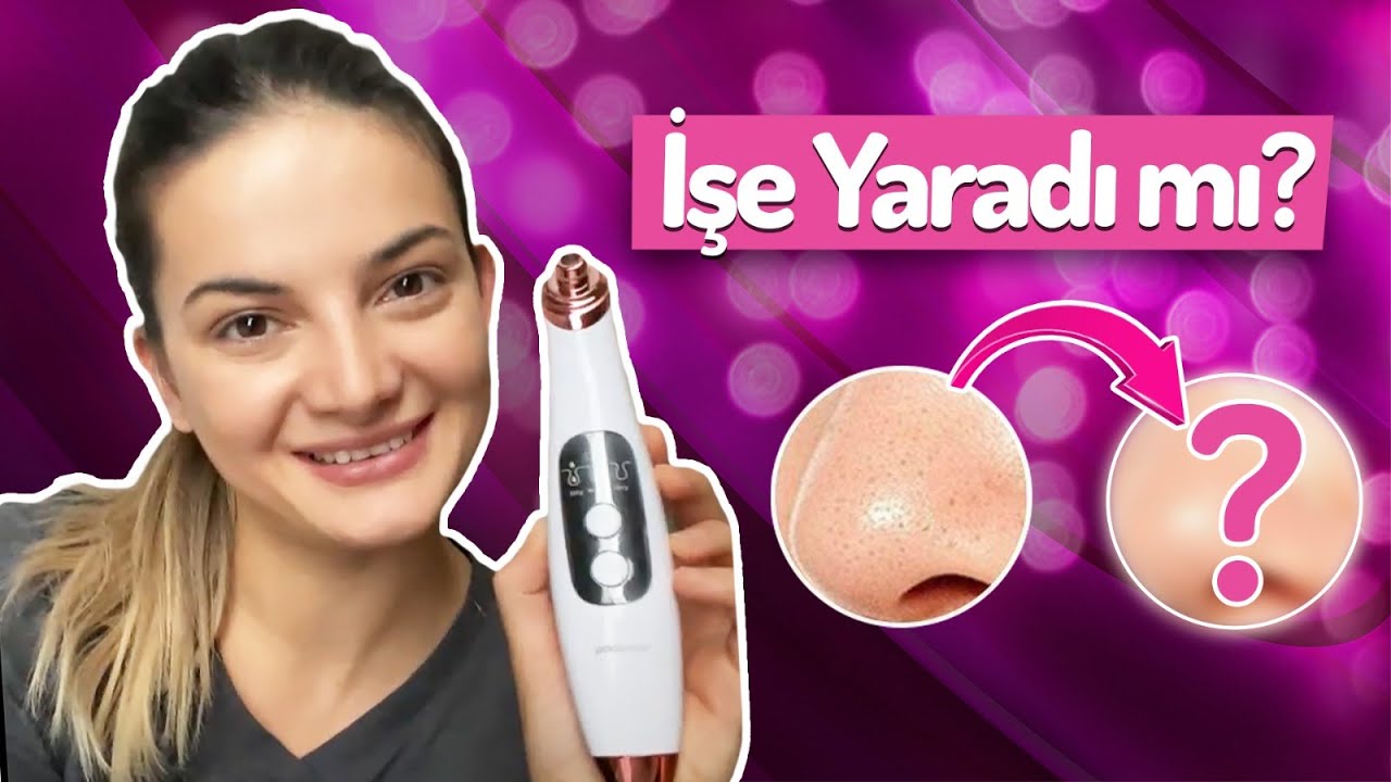 BİM’den 59,90 TL'ye siyah nokta temizleyici aldım 🥰 (Polosmart beauty)