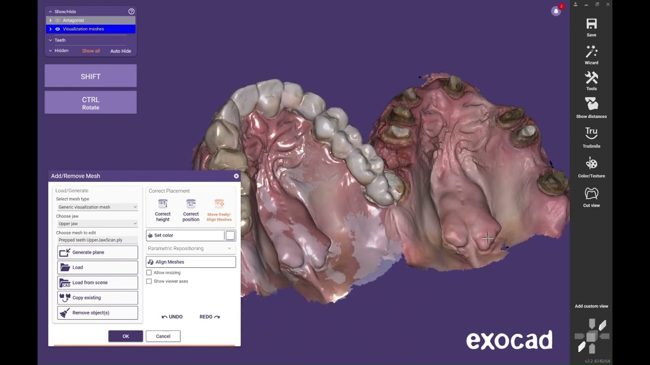 Aligning Multiple scans in Exocad