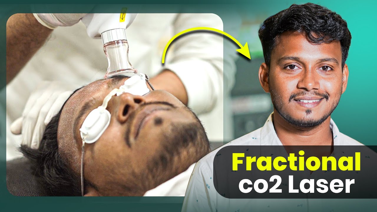 Fractional CO2 Laser: The Secret to Radiant Skin 😍 | Kolkata | New Roots