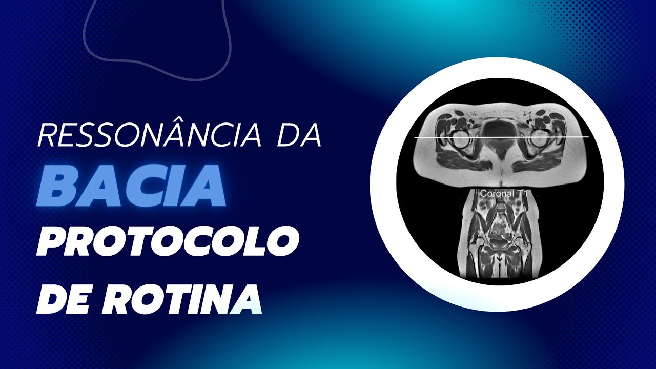 Planejamento de Exames em Ressonância Magnética