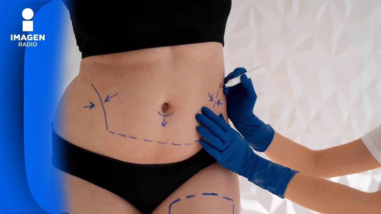 Las nuevas liposucciones eliminan grasa con menos dolor