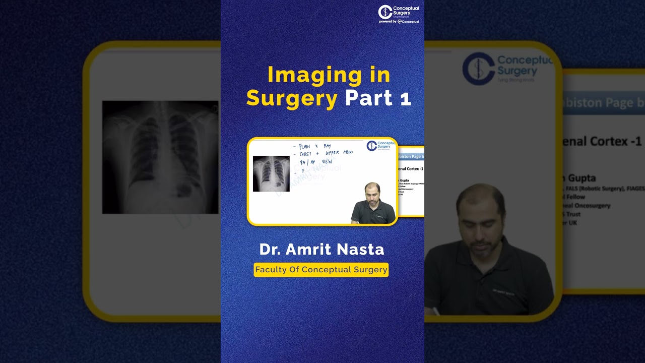 Top 5 Most Loved In-App Live Sessions of JULY | Conceptual Surgery | Surgery Residency #short