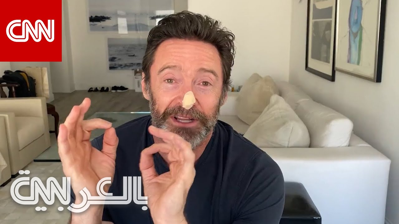 إليك كيفية الحفاظ على سلامتك أثناء قضاء الوقت تحت أشعة الشمس