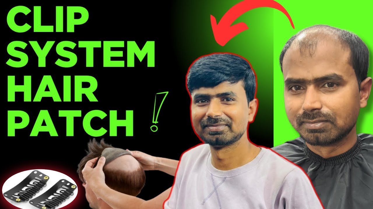 Clipping Hair Patch Review | Clipping Hair Patch For Men  | Clip System Hair Patch | Hair Patch Clip