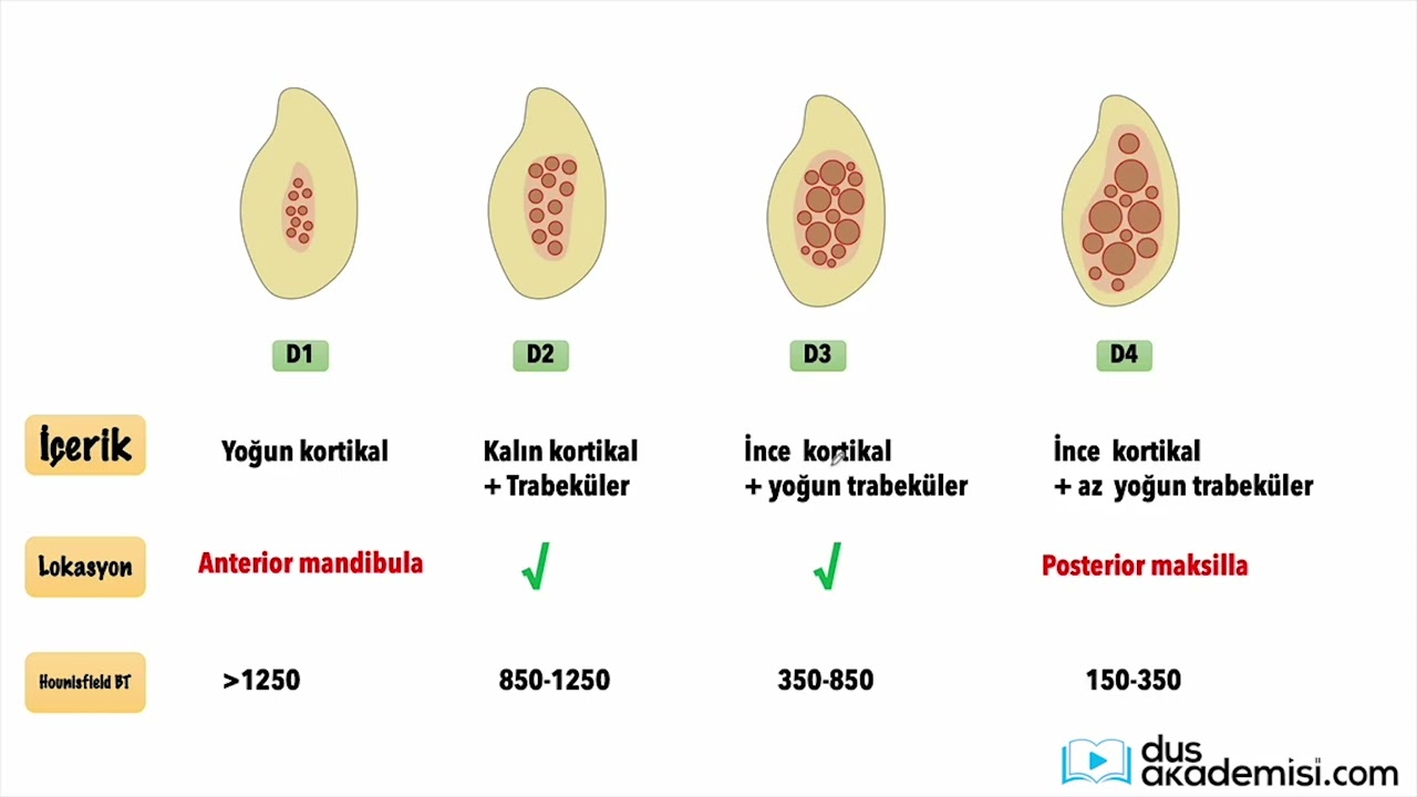 dusakademisi.com AĞIZ DİŞ ve ÇENE CERRAHİSİ Paketi İmplant Konu Anlatım