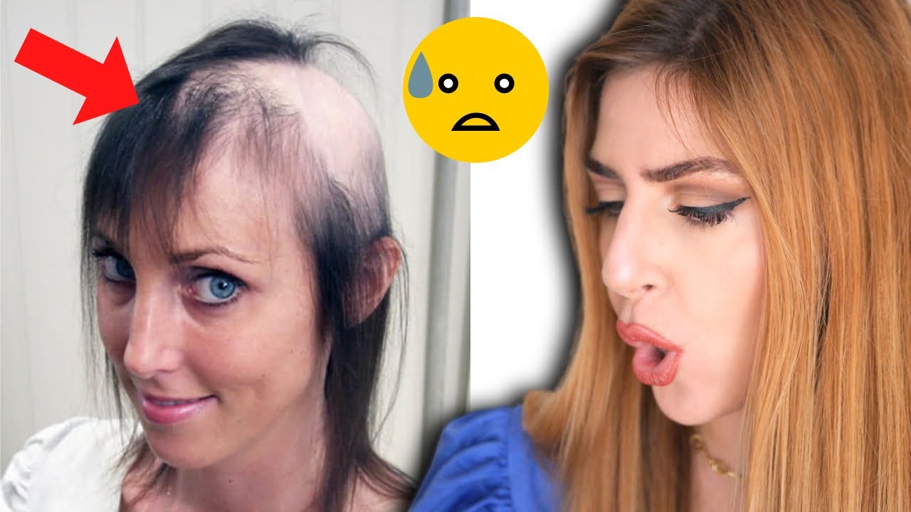 CADUTA CAPELLI! RIMEDI #TikTok per CAPELLI che CADONO  Reaction HAIR TOK #hairstyle