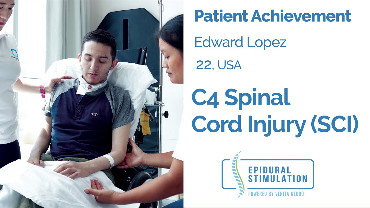 Edward’s Remarkable Progress After C4 SCI and Epidural Stimulation Treatment