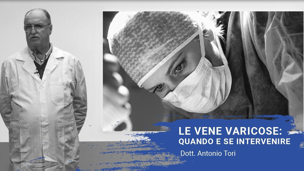 Vene varicose: quando e se intervenire - Dott. Antonio Tori